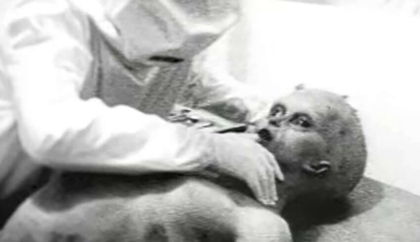 Foto da famosa autópsia alienígena de 1947