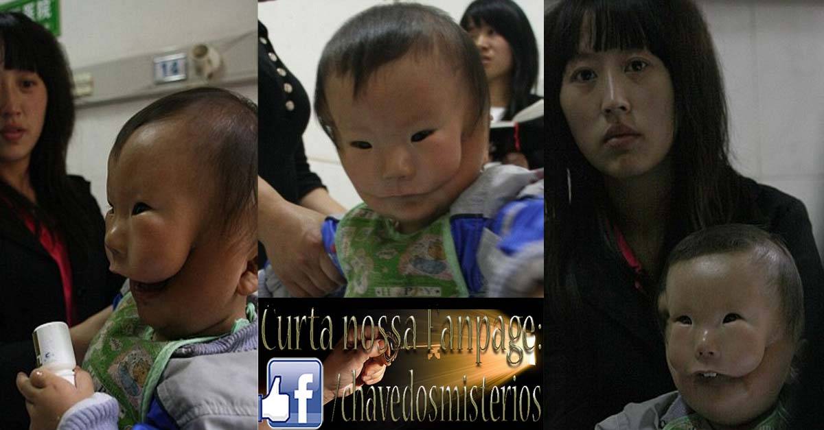 De partir o coração A dura história do menino da máscara