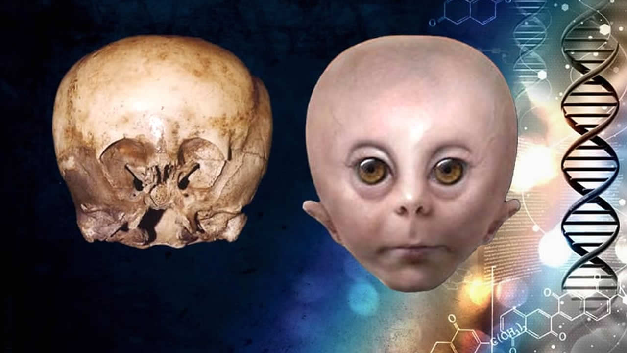 A misteriosa história por trás do StarChild Skull